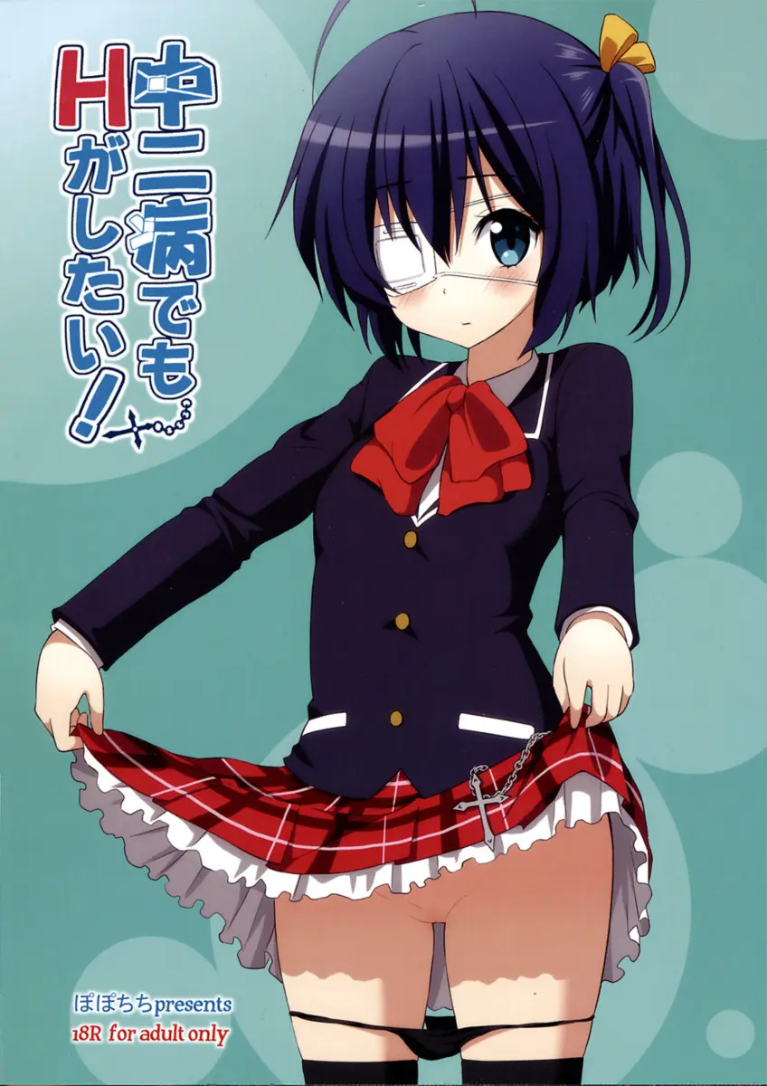 Chuunibyou Demo H ga Shitai! - Foto 22